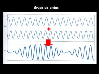 + Grupo de ondas 