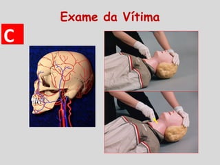 CC
Exame da Vítima
 