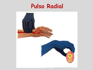 Pulso Radial
 