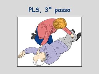 PLS, 3º passo
 