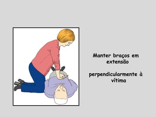 Manter braços em
extensão
perpendicularmente à
vítima
 