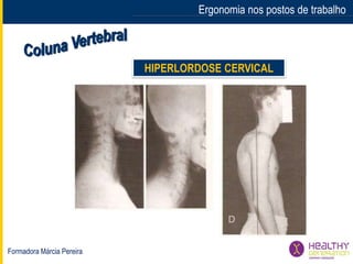 Formadora Márcia Pereira
Ergonomia nos postos de trabalho
HIPERLORDOSE CERVICAL
 