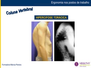 Formadora Márcia Pereira
Ergonomia nos postos de trabalho
HIPERCIFOSE TORÁCICA
 