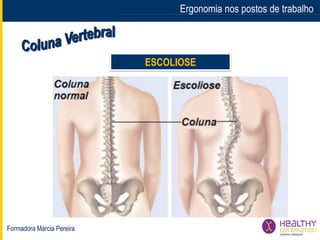 Formadora Márcia Pereira
Ergonomia nos postos de trabalho
ESCOLIOSE
 