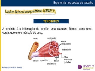Formadora Márcia Pereira
Ergonomia nos postos de trabalho
TENDINITES
A tendinite é a inflamação do tendão, uma estrutura fibrosa, como uma
corda, que une o músculo ao osso.
 