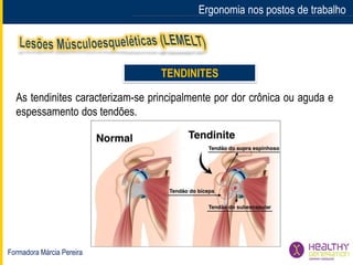 Formadora Márcia Pereira
Ergonomia nos postos de trabalho
TENDINITES
As tendinites caracterizam-se principalmente por dor crônica ou aguda e
espessamento dos tendões.
 