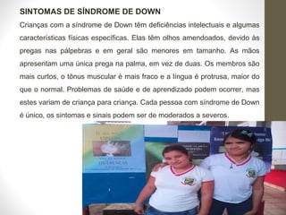 SINTOMAS DE SÍNDROME DE DOWN
Crianças com a síndrome de Down têm deficiências intelectuais e algumas
características físicas específicas. Elas têm olhos amendoados, devido às
pregas nas pálpebras e em geral são menores em tamanho. As mãos
apresentam uma única prega na palma, em vez de duas. Os membros são
mais curtos, o tônus muscular é mais fraco e a língua é protrusa, maior do
que o normal. Problemas de saúde e de aprendizado podem ocorrer, mas
estes variam de criança para criança. Cada pessoa com síndrome de Down
é único, os sintomas e sinais podem ser de moderados a severos.
 