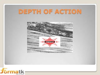 DEPTH OF ACTION

 