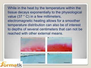 While in the heat by the temperature within the
tissue decays exponentially to the physiological
value (37 ° C) in a few millimeters,
electromagnetic heating allows for a smoother
temperature distribution can also be of interest
to depths of several centimeters that can not be
reached with other external means.

 