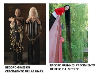 RECORD GINÉS EN
CRECIMIENTO DE LAS UÑAS.
RECORD GUINNES CRECIMIENTO
DE PELO 2,4 METROS