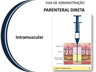 VIAS DE ADMINISTRAÇÃO

                PARENTERAL DIRETA




Intramuscular
 