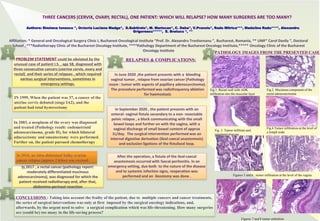RESEARCH POSTER PRESENTATION DESIGN © 2019
www.PosterPresentations.com
IN 1999, When the patient was 37, a cancer of the
uterine cervix debuted (stage IA2), and the
patient had total hysterectomy
PROBLEM STATEMENT could be obviated by the
unusual case of patient I.S. , age 58, diagnosed with
three consecutive cancers (uterine cervix, ovary and
rectal) and their series of relapses , which required
various surgical interventions, sometimes in
emergency settings.
In 2003, a neoplasm of the ovary was diagnosed
and treated (Pathology result: endometrioid
adenocarcinoma, grade II), for which bilateral
adnexectomy and omentectomy were performed.
Further on, the patient pursued chemotherapy .
In 2016, an intra-abdominal bulky ovarian
cancer relapse (approx 2 kilos) was excised
In 2017 , a rectal cancer (pathology report:
moderately differentiated mucinous
adenocarcinoma), was diagnosed for which the
patient received radiotherapy and, after that,
abdomino-perineal resection
RELAPSES & COMPLICATIONS:
In June 2020 ,the patient presents with a bleeding
vaginal tumor , relapse from ovarian cancer (Pathology
exam : tumor with aspects of papillary adenocarcinoma).
The procedure performed was radiofrequency ablation
for haemostasis
In September 2020 , the patient presents with an
enteral- vaginal fistula secondary to a non- resectable
pelvic relapse , a block communicating with the small
bowel loops and further on with the vagina, with a
vaginal discharge of small bowel content of approx
1L/day. The surgical intervention performed was an
internal digestive derivation (ileal-caecal anastomosis)
and exclusion ligations of the fistulised loop.
After the operation, a fistula of the ileal-caecal
anastomosis occurred with faecal peritonitis. In an
emergency setting, due both to the nature of the disease
and to systemic infection signs, reoperation was
performed and an ileostomy was done .
CONCLUSIONS : Taking into account the frailty of the patient, due to multiple cancers and cancer treatments,
the series of surgical interventions was only at first imposed by the surgical oncology indications, and,
afterwards, by the urgent need to solve a surgical complication which was life-threatening. How many surgeries
are (could be) too many in the life-saving process?
Affiliation: * General and Oncological Surgery Clinic I, Bucharest Oncological Institute “Prof. Dr. Alexandru Trestioreanu ”, Bucharest, Romania, ** UMF“ Carol Davila ”, Doctoral
School , ***Radiotherapy Clinic of the Bucharest Oncology Institute, ****Pathology Department of the Bucharest Oncology Institute,***** Oncology Clinic of the Bucharest
Oncology Institute
Authors: Sinziana Ionescu *, Octavia Luciana Madge*, D.Subtirelu*, M. Marincas*, C. Daha*, V.Prunoiu*, Radu Mitrica***, Madalina Radu****, Alexandru
Grigorescu*****, E. Bratucu *, **
THREE CANCERS (CERVIX, OVARY, RECTAL), ONE PATIENT: WHICH WILL RELAPSE? HOW MANY SURGERIES ARE TOO MANY?
1
2
3
Fig.1. Rectal wall with ADK
infiltration into the muscular layer
Fig.2. Mucinous component of the
rectal adenocarcinoma
Fig.4.Tumor infiltration at the level of
a lymph node
Figures 5 and 6 : tumor infiltration at the level of the vagina
Figures 7 and 8 tumor embolism
Fig. 3. Tumor infiltrate and
squamous mucosa
PATHOLOGY IMAGES FROM THE PRESENTED CASE
4
 