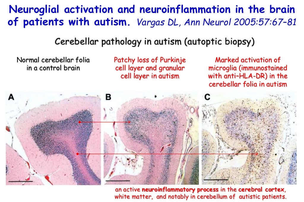 can food allergies affect your brain