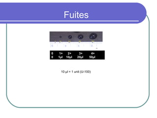 Fuites

0
0

1+
1µl

2+
10µl

3+
20µl

4+
50µl

10 µl = 1 unit (U-100)

 