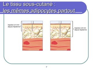 Le tissu sous-cutané :
les mêmes adipocytes partout
Injection à 4 mm
depuis l’épiderme

Injection à 8 mm
depuis l’épiderme

7

 