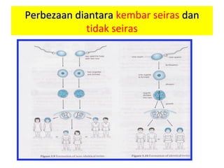 Perbezaan diantaraPerbezaan diantara kembar seiras dandan
tidak seiras
 