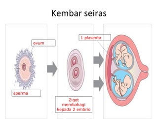 Kembar seiras
ovum
sperma
Zigot
membahagi
kepada 2 embrio
1 plasenta
 