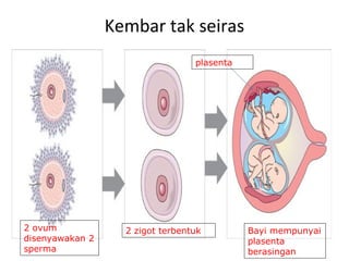 Kembar tak seiras
2 zigot terbentuk2 ovum
disenyawakan 2
sperma
Bayi mempunyai
plasenta
berasingan
plasenta
 