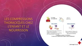 LES COMPRESSIONS
THORACIQUES CHEZ
L’ENFANT ET LE
NOURRISSON
 