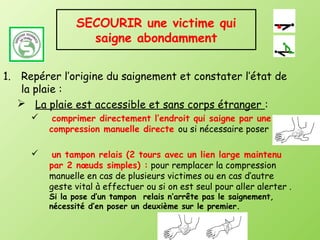 SECOURIR une victime qui
                 saigne abondamment


1. Repérer l’origine du saignement et constater l’état de
   la plaie :
    La plaie est accessible et sans corps étranger :
         comprimer directement l’endroit qui saigne par une
         compression manuelle directe ou si nécessaire poser

         un tampon relais (2 tours avec un lien large maintenu
         par 2 nœuds simples) : pour remplacer la compression
         manuelle en cas de plusieurs victimes ou en cas d’autre
         geste vital à effectuer ou si on est seul pour aller alerter .
         Si la pose d’un tampon relais n’arrête pas le saignement,
         nécessité d’en poser un deuxième sur le premier.
 
