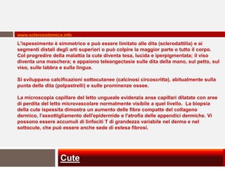 www.sclerosistemica.info
L'ispessimento è simmetrico e può essere limitato alle dita (sclerodattilia) e ai
segmenti distali degli arti superiori o può colpire la maggior parte o tutto il corpo.
Col progredire della malattia la cute diventa tesa, lucida e iperpigmentata; il viso
diventa una maschera; e appaiono teleangectasie sulle dita della mano, sul petto, sul
viso, sulle labbra e sulla lingua.

Si sviluppano calcificazioni sottocutanee (calcinosi circoscritta), abitualmente sulla
punta delle dita (polpastrelli) e sulle prominenze ossee.

La microscopia capillare del letto ungueale evidenzia anse capillari dilatate con aree
di perdita del letto microvascolare normalmente visibile a quel livello. La biopsia
della cute ispessita dimostra un aumento delle fibre compatte del collageno
dermico, l'assottigliamento dell'epidermide e l'atrofia delle appendici dermiche. Vi
possono essere accumuli di linfociti T di grandezza variabile nel derma e nel
sottocute, che può essere anche sede di estesa fibrosi.




                  Cute
 