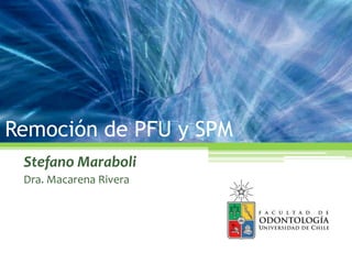 Remoción de PFU y SPM
Stefano Maraboli
Dra. Macarena Rivera
 
