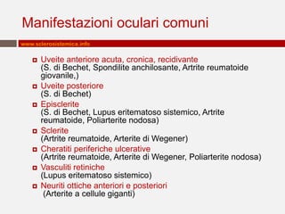 Manifestazioni oculari comuni
www.sclerosistemica.info











Uveite anteriore acuta, cronica, recidivante
(S. di Bechet, Spondilite anchilosante, Artrite reumatoide
giovanile,)
Uveite posteriore
(S. di Bechet)
Episclerite
(S. di Bechet, Lupus eritematoso sistemico, Artrite
reumatoide, Poliarterite nodosa)
Sclerite
(Artrite reumatoide, Arterite di Wegener)
Cheratiti periferiche ulcerative
(Artrite reumatoide, Arterite di Wegener, Poliarterite nodosa)
Vasculiti retiniche
(Lupus eritematoso sistemico)
Neuriti ottiche anteriori e posteriori
(Arterite a cellule giganti)

 