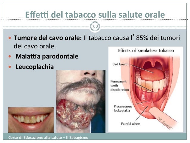 La vitamina d a impotenza