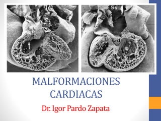 MALFORMACIONES
CARDIACAS
Dr. Igor Pardo Zapata
 