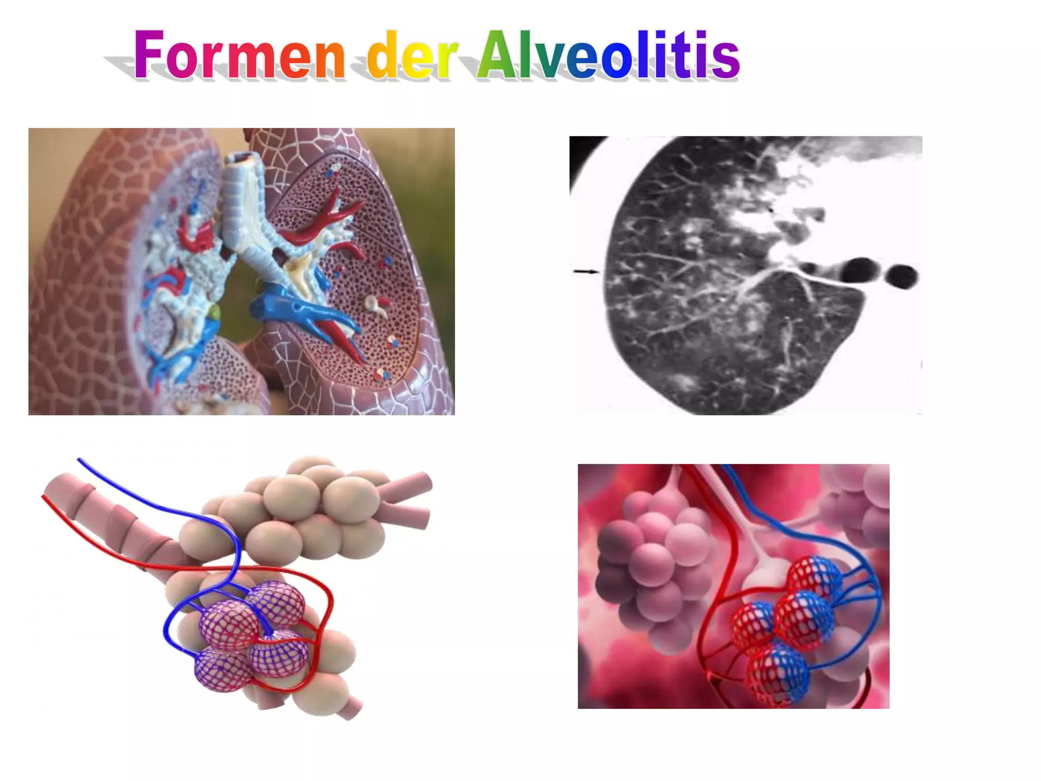 Alveolitis Sicca Nach 7 Tagen Formen der Alveolitis, Allgemeine Funktionsdiagnostik mit (BGA