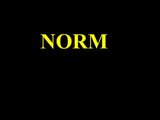 NORM 
