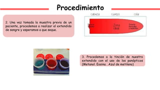 Procedimiento
2. Una vez tomada la muestra previa de un
paciente, procedemos a realizar el extendido
de sangre y esperamos a que seque.
3. Procedemos a la tinción de nuestro
extendido con el uso de los panópticos
(Metanol. Eosina . Azul de metileno)
 