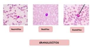Neutrófilos Basófilos Eosinófilos
GRANULOCITOS
 