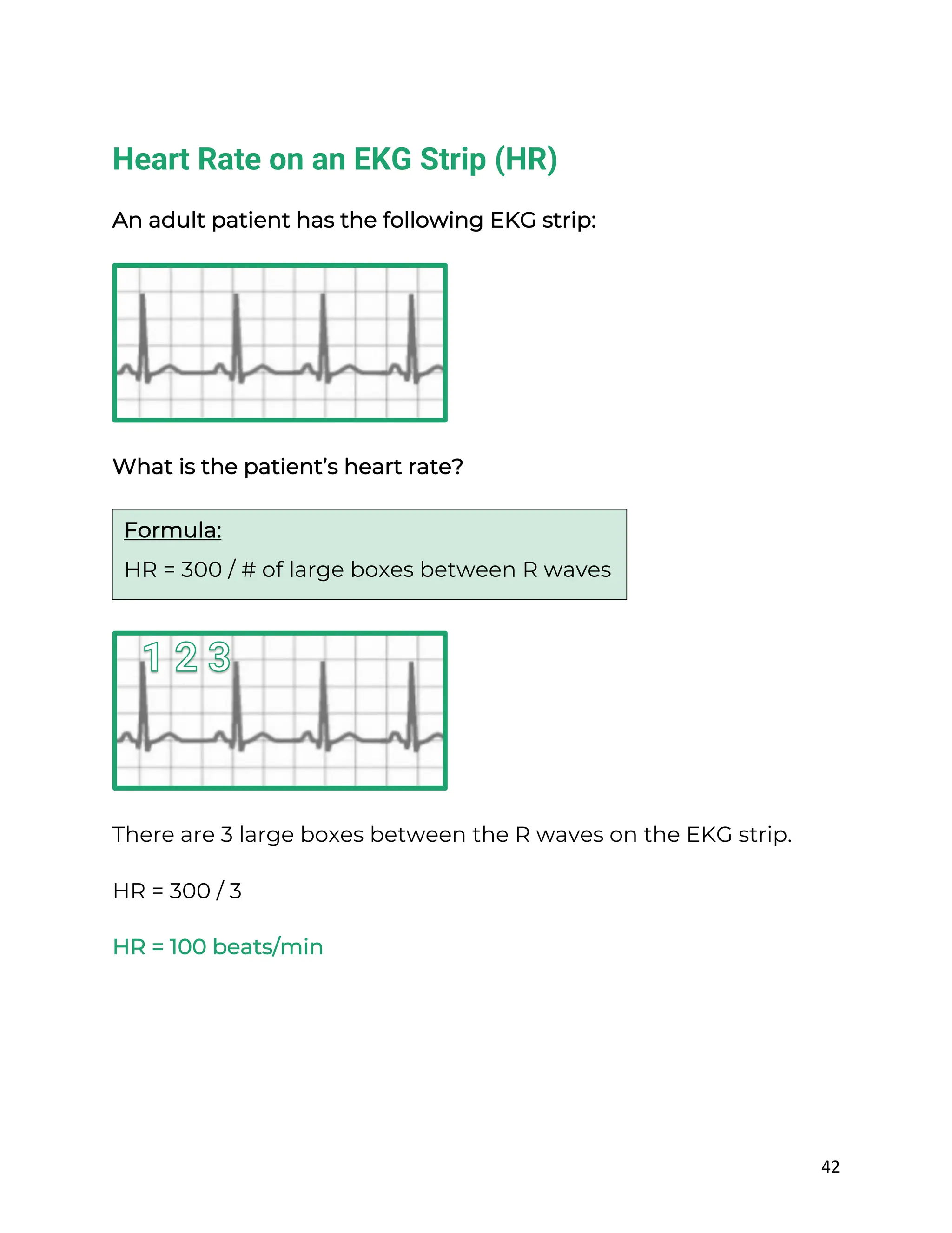42
Heart Rate on an EKG Strip (HR)
An adult patient has the following EKG strip:
What is the patient’s heart rate?
There are 3 large boxes between the R waves on the EKG strip.
HR = 300 / 3
HR = 100 beats/min
Formula:
HR = 300 / # of large boxes between R waves
 