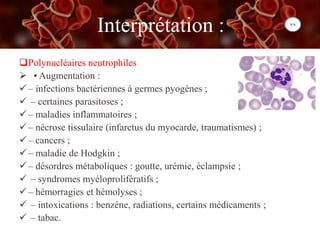 Interprétation :
Polynucléaires neutrophiles
 • Augmentation :
– infections bactériennes à germes pyogènes ;
 – certaines parasitoses ;
– maladies inflammatoires ;
– nécrose tissulaire (infarctus du myocarde, traumatismes) ;
– cancers ;
– maladie de Hodgkin ;
– désordres métaboliques : goutte, urémie, éclampsie ;
 – syndromes myéloprolifératifs ;
– hémorragies et hémolyses ;
 – intoxications : benzène, radiations, certains médicaments ;
 – tabac.
 