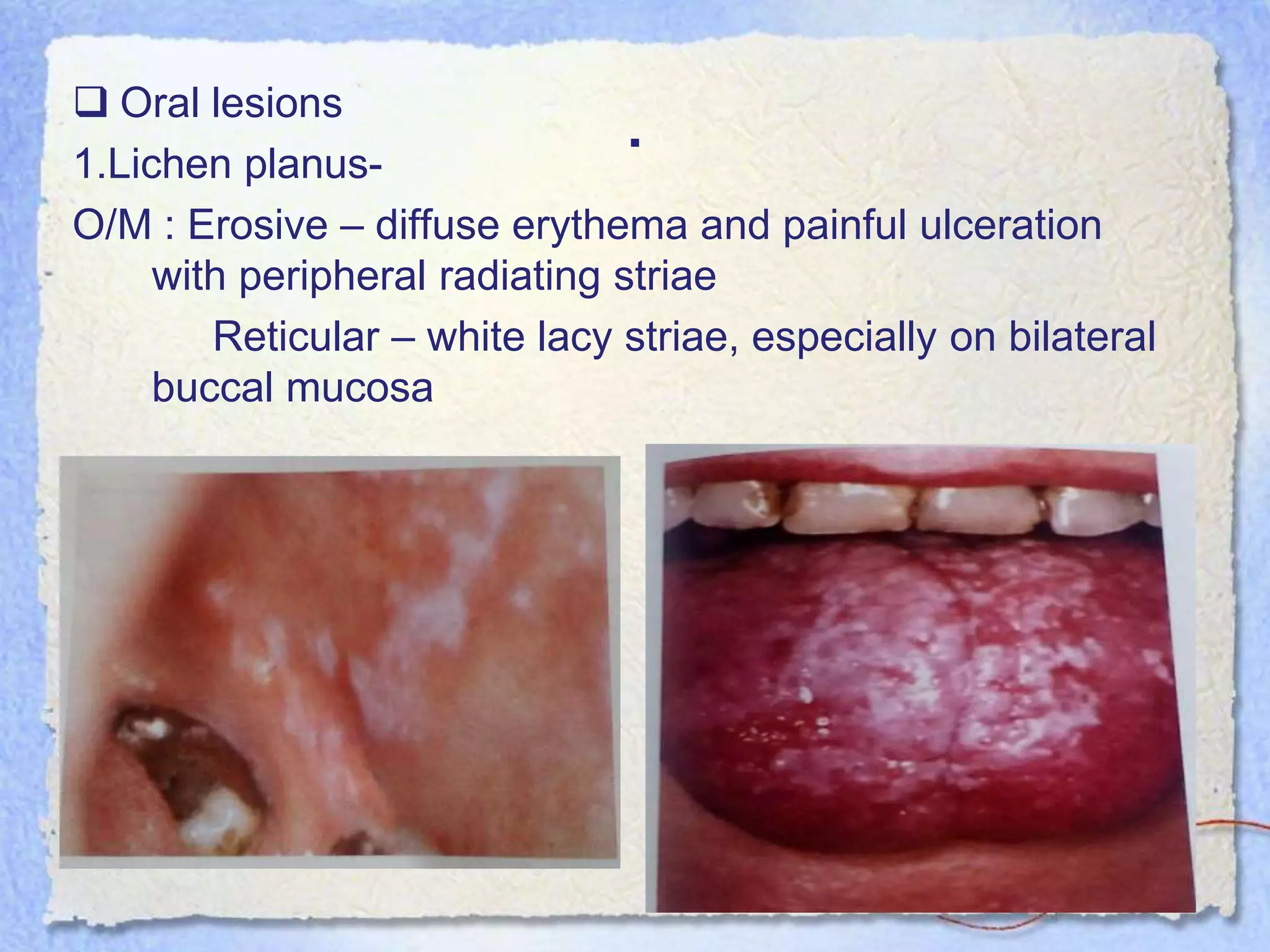 Basics of Dentistry | PPSX