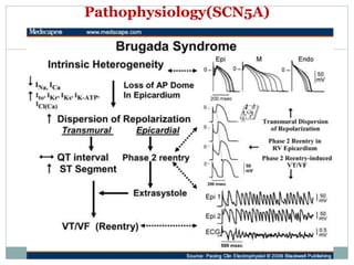 Brugada Syndrome PPTX Brugada Syndrome PPTX