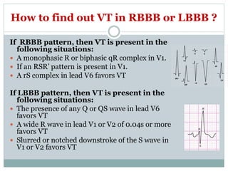 How to find out VT in RBBB or LBBB ?
If RBBB pattern, then VT is present in the
following situations:
 A monophasic R or biphasic qR complex in V1.
 If an RSR’ pattern is present in V1.
 A rS complex in lead V6 favors VT
If LBBB pattern, then VT is present in the
following situations:
 The presence of any Q or QS wave in lead V6
favors VT
 A wide R wave in lead V1 or V2 of 0.04s or more
favors VT
 Slurred or notched downstroke of the S wave in
V1 or V2 favors VT
 