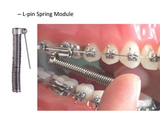 – L-pin Spring Module
 