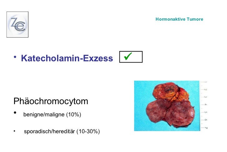 Welche endokrinen Erkrankungen gehören operiert und welche sicher n…