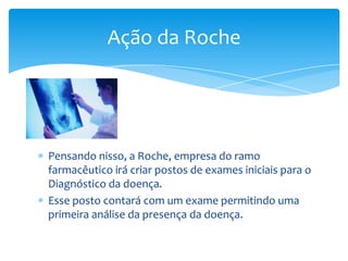 Ação da Roche

Pensando nisso, a Roche, empresa do ramo
farmacêutico irá criar postos de exames iniciais para o
Diagnóstico da doença.
Esse posto contará com um exame permitindo uma
primeira análise da presença da doença.

 