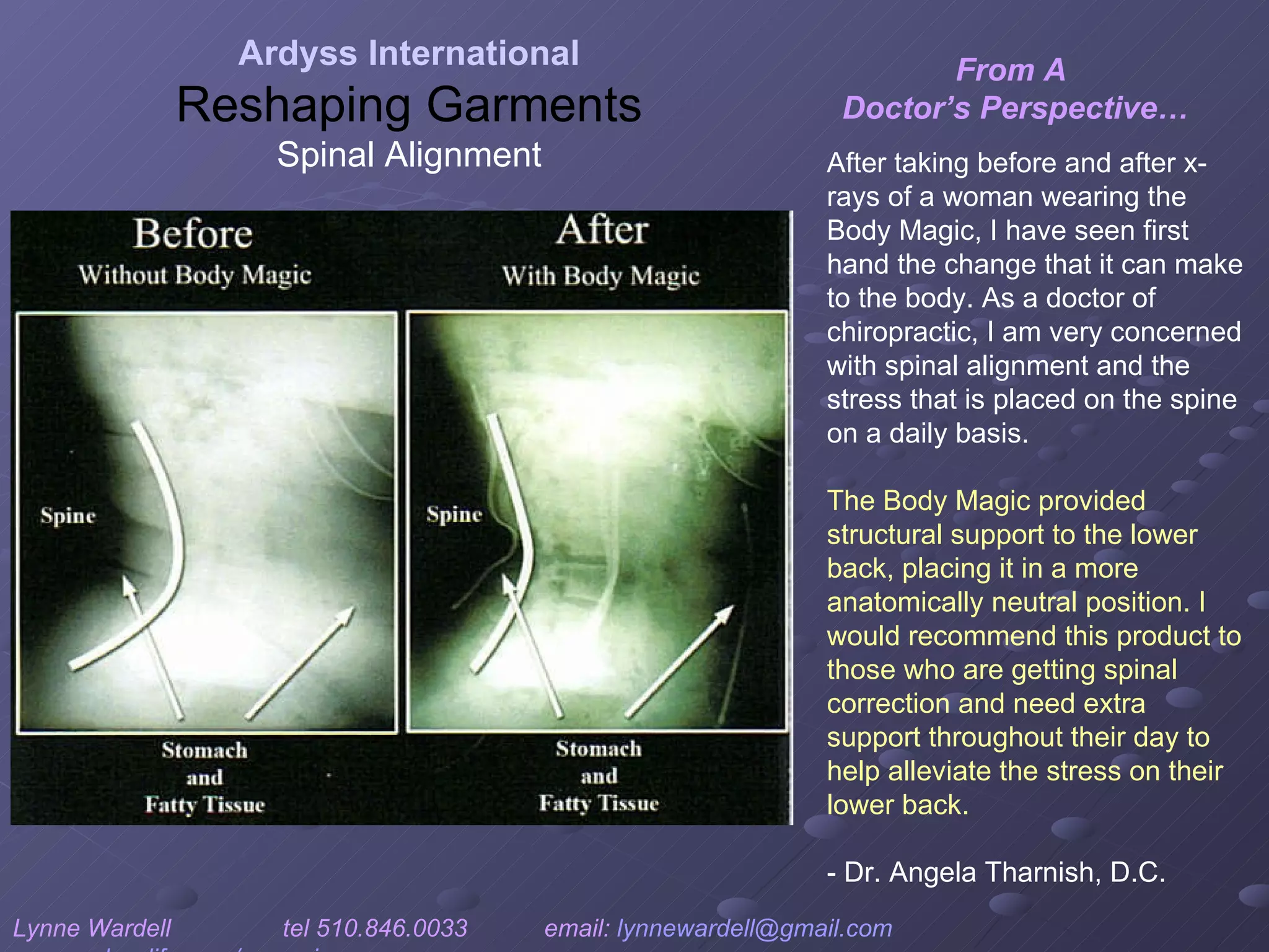 From A  Doctor’s Perspective… Ardyss International Reshaping Garments Spinal Alignment Lynne Wardell  tel 510.846.0033  email:  [email_address]   www.ardysslife.com/ezmoxie   After taking before and after x-rays of a woman wearing the Body Magic, I have seen first hand the change that it can make to the body. As a doctor of chiropractic, I am very concerned with spinal alignment and the stress that is placed on the spine on a daily basis. The Body Magic provided structural support to the lower back, placing it in a more anatomically neutral position. I would recommend this product to those who are getting spinal correction and need extra support throughout their day to help alleviate the stress on their lower back. - Dr. Angela Tharnish, D.C.   