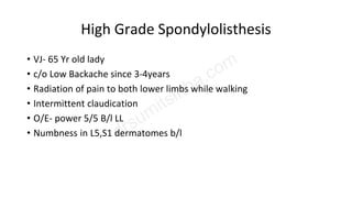 High Grade Spondylolisthesis
• VJ- 65 Yr old lady
• c/o Low Backache since 3-4years
• Radiation of pain to both lower limbs while walking
• Intermittent claudication
• O/E- power 5/5 B/l LL
• Numbness in L5,S1 dermatomes b/l
 