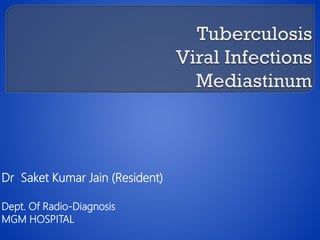 Dr Saket Kumar Jain (Resident)
Dept. Of Radio-Diagnosis
MGM HOSPITAL

 