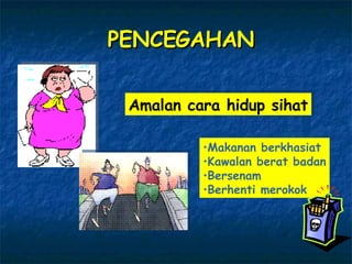 Amalan cara hidup sihat Makanan berkhasiat Kawalan berat badan Bersenam Berhenti merokok PENCEGAHAN 