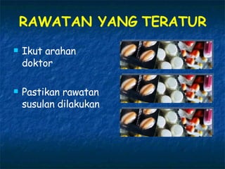 RAWATAN YANG TERATUR Ikut arahan doktor Pastikan rawatan susulan dilakukan 