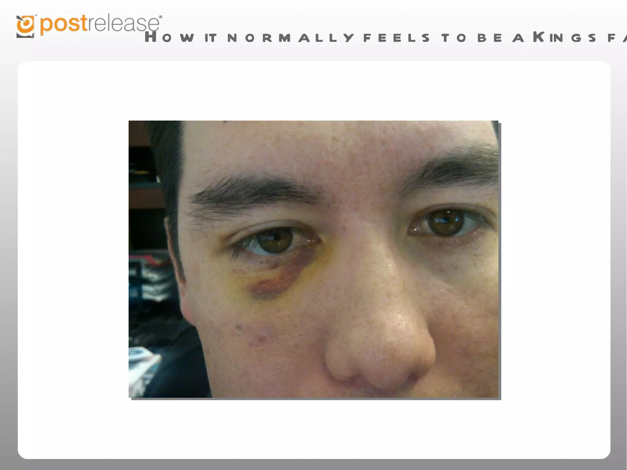 How it normally feels to be a Kings fan
 