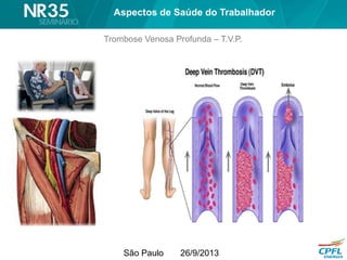 São Paulo 26/9/2013
Trombose Venosa Profunda – T.V.P.
Aspectos de Saúde do Trabalhador
 