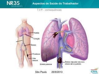 São Paulo 26/9/2013
T.V.P. - consequências
Aspectos de Saúde do Trabalhador
 