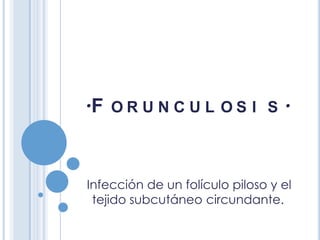 .F

ORUNCUL OS I S

.

Infección de un folículo piloso y el
tejido subcutáneo circundante.

 